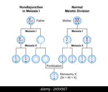 Conception scientifique de la non-disjonction en monosomie X (syndrome de Turner) . Symboles colorés. Illustration vectorielle. Illustration de Vecteur