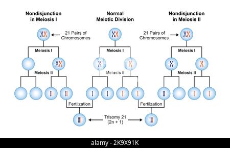 Conception scientifique de la non-disjonction en trisomie 21. Symboles colorés. Illustration vectorielle. Illustration de Vecteur
