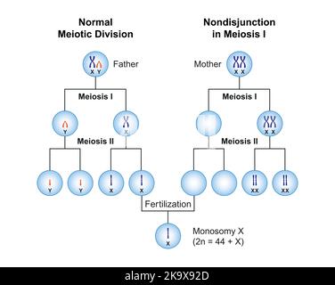 Conception scientifique de la non-disjonction en monosomie X (syndrome de Turner) . Symboles colorés. Illustration vectorielle. Illustration de Vecteur