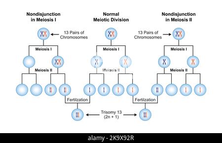 Conception scientifique de la non-disjonction en trisomie 13. Symboles colorés. Illustration vectorielle. Illustration de Vecteur