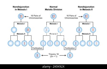 Conception scientifique de la non-disjonction en trisomie 16. Symboles colorés. Illustration vectorielle. Illustration de Vecteur