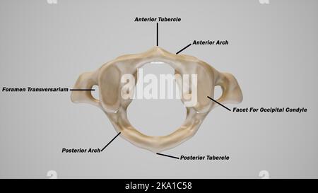 Rachis cervical, première vertèbre cervicale (Atlas) - vue supérieure marquée Banque D'Images