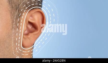 Gros plan d'un homme avec une oreille marron. Concept de test auditif et de chirurgie de l'oreille. Banque D'Images