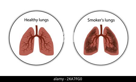 Poumons sains et fumeurs icône des poumons dans les cercles isolés sur blanc. Style de dessin animé. Icône de vecteur ou élément de conception. Illustration de Vecteur
