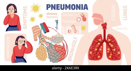 Infographiques de pneumonie humaine avec des personnages féminins de style dessin animé légendes de texte et icônes de bactéries avec poumons illustration de vecteur Illustration de Vecteur