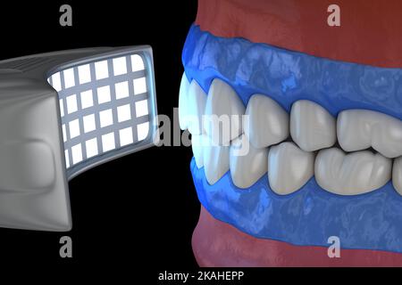 Blanchiment professionnel des dents. Voyant d'activation du gel. 3D concept d'illustration. Banque D'Images