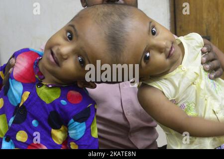 Les filles jumelles Rabeya Islam et Rokeya Islam jouent dans un hôpital de Collage médical de Dhaka, au Bangladesh, sur 21 novembre 2017. Taslima Khatun, professeur d'école, a donné naissance aux jumeaux à tête conjointe le 16 juillet 2016 après une césarienne. Les jumeaux ont été admis à un hôpital médical de Dhaka pour examen avant une éventuelle chirurgie pour séparer leurs têtes. (Photo par Mamunur Rashid/NurPhoto) Banque D'Images