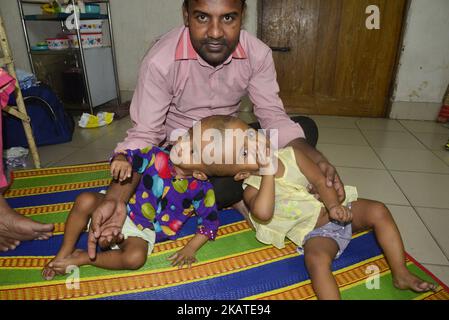 Les filles jumelles Rabeya Islam et Rokeya Islam jouent dans un hôpital de Collage médical de Dhaka, au Bangladesh, sur 21 novembre 2017. Taslima Khatun, professeur d'école, a donné naissance aux jumeaux à tête conjointe le 16 juillet 2016 après une césarienne. Les jumeaux ont été admis à un hôpital médical de Dhaka pour examen avant une éventuelle chirurgie pour séparer leurs têtes. (Photo par Mamunur Rashid/NurPhoto) Banque D'Images