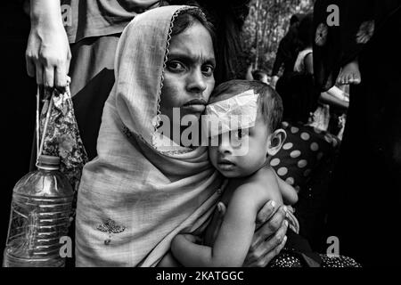 La réfugiée de Rohingya, qui a une blessure à la tête, attend une aide médicale dans une clinique de terrain par l'organisation non gouvernementale Mercy Malaysia au camp de réfugiés de Thankhali près de Cox's Bazar, au Bangladesh, à 22 novembre 2017. (Photo de Szymon Barylski/NurPhoto) Banque D'Images