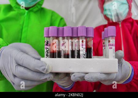 Un personnel médical montrant des échantillons de sang pendant un test de coronavirus COVID-19 pour les travailleurs de graves à Yogyakarta, 25 avril 2020. (Photo par Adriana Adie/NurPhoto) Banque D'Images