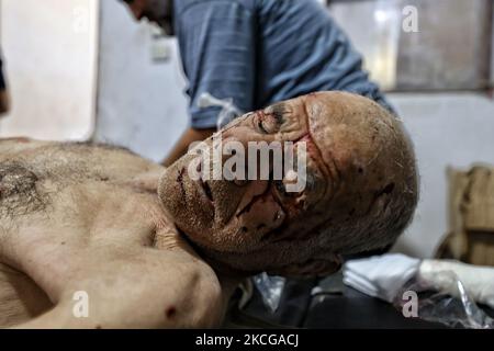 (NOTE DE LA RÉDACTION : l'image dépeint le contenu graphique) un homme blessé se fait soigner dans un hôpital après que les forces du régime d'Assad, rejointes par des groupes terroristes soutenus par l'Iran, aient attaqué des zones résidentielles dans les villages de Bara et Ihsim, dans la zone de désescalade d'Idlib, en Syrie, sur 21 juin 2021. Au moins 7 civils ont été tués et 10 autres blessés. (Photo par Muhammad al-Rifai/NurPhoto) Banque D'Images