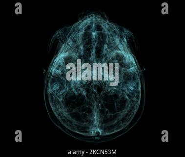 Base humaine du crâne, cerveau par acquisition CT. Visualisation des rayons X à l'intérieur du crâne. 3D rendu d'illustration. Banque D'Images