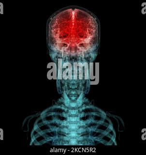 3D a rendu une illustration médicalement précise de l'artère cérébrale de la tête Banque D'Images