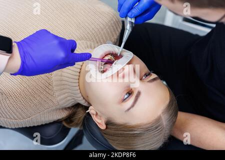 Les dents d'une femme avec des bretelles métalliques sont traitées à la clinique. Un orthodontiste utilise des instruments dentaires pour placer des bretelles sur les dents d'un patient. Sélection Banque D'Images