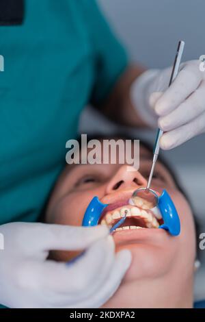 Grand angle de jeune femme ethnique avec enrouleur de joue allongé sur la chaise tandis que croiser un dentiste anonyme en utilisant le miroir de bouche pour appliquer le remplissage pendant Banque D'Images