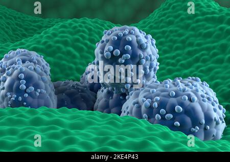 Cellules cancéreuses de la prostate dans l'épithélium glandulaire prostatique - vue rapprochée 3D illustration Banque D'Images