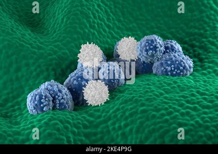 Les cellules T attaquent les cellules cancéreuses de la prostate dans l'épithélium glandulaire prostatique - vue isométrique 3D illustration Banque D'Images