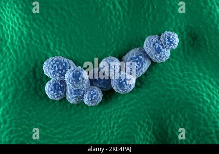 Cellules cancéreuses de la prostate dans l'épithélium glandulaire prostatique - vue de dessus 3D illustration Banque D'Images