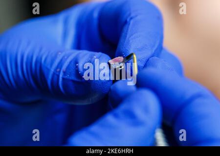 Entretoises métalliques pour l'installation de la structure sur les dents dans les mains d'un orthodontiste. L'orthodontiste tient de nouvelles bretelles dans ses mains, la prépare pour Banque D'Images