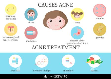 Causes d'acné et schéma de traitement, illustration de la conception de style plat de vecteur. Les principaux facteurs causent l'acné et le traitement de soins de la peau à l'information de thérapie médicale Illustration de Vecteur