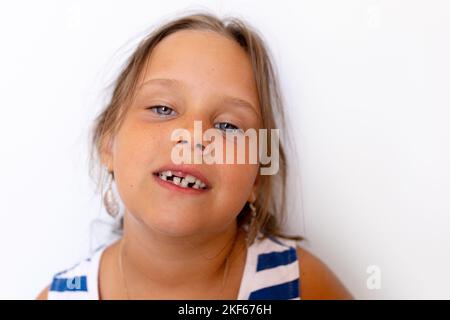 Insouciante, calme, confiante petite fille blonde montre bébé dents temporaires de lait. Bouche sans dents avec dents modifiées tortravers Banque D'Images
