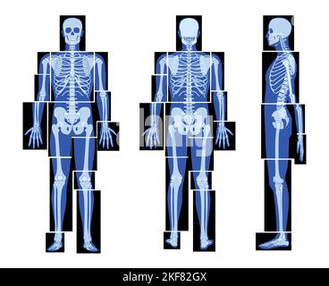 Ensemble de parties du corps humain du squelette à rayons X - mains, jambes, poitrine, tête, vertèbre, Bassin, os adultes personnes roentgen avant vue latérale arrière. 3D concept plat réaliste Illustration vectorielle de l'anatomie médicale Illustration de Vecteur