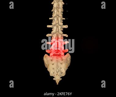 Acquisition CT du rendu du rachis lombaire 3D montrant le profil du rachis humain. Système musculo-squelettique corps humain. Courbe de contrôle de structure. Étudier les maladies à problèmes et les Tre Banque D'Images