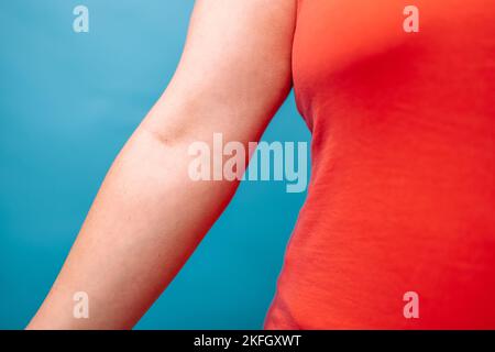 Don de sang. Femme en T-shirt rouge avec les mains avec patch après avoir donné du sang Banque D'Images