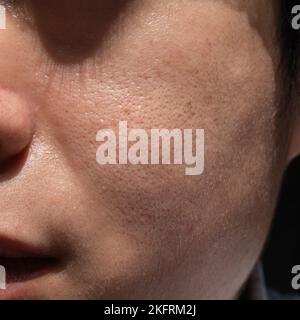 Peau équitable avec de larges pores face à un jeune homme adulte d'Asie du Sud-est, du Myanmar ou de Corée. Banque D'Images