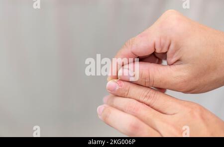 La main femelle tornant la peau sèche et fissurée sur les cuticules, la peau est déchirée et écaillée devrait être traitée avec la crème hydratante pour réparation. Banque D'Images