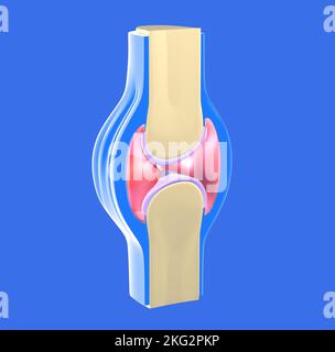 3D illustration d'une articulation synoviale avec arthrose. Représentation graphique des os, des tendons et du cartilage. Banque D'Images