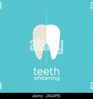 Blanchiment des dents. Avant et après. Concepts dentaires. Illustration vectorielle, conception plate Illustration de Vecteur