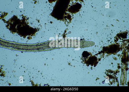 parasite humain. maladie intestinale d'infection intestinale. infection des micro-organismes à l'hôpital chez les personnes Banque D'Images