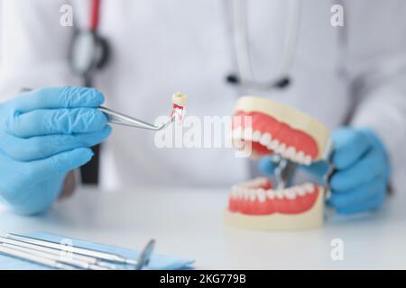 Dentiste tenant la dent avec une pince à épiler et montrant le modèle de mâchoire Banque D'Images