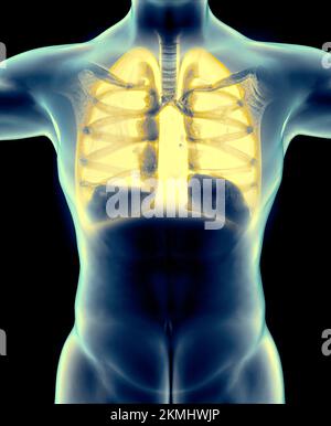 Anatomie humaine, problèmes avec le système respiratoire, poumons gravement endommagés. Pneumonie bilatérale. Covid-19, coronavirus. Patient et fumée. Fumeur Banque D'Images