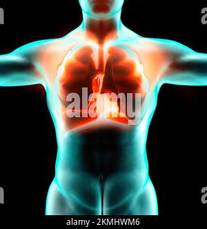 Anatomie humaine, problèmes avec le système respiratoire, poumons gravement endommagés. Pneumonie bilatérale. Covid-19, coronavirus. Patient et fumée. Fumeur Banque D'Images