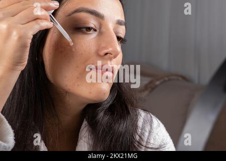 Femme qui goutte du sérum de soin de la peau de la pipette sur sa joue. Jeune fille millénaire de race blanche appliquant un traitement hydratant d'acné à son visage. Banque D'Images