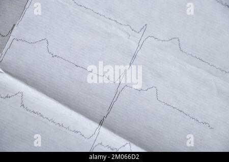 cardiogramme sur l'ancien papier comme photo macro d'arrière-plan Banque D'Images