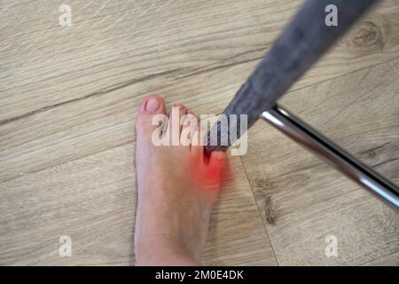 Une femme a frappé la chaise avec le petit orteil. Incident à la maison. Tache rouge montrant une blessure du pied petit doigt Banque D'Images