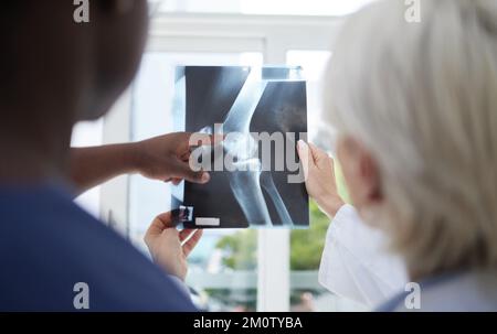 Tant de fractures dans un seul os. un médecin mature et sa collègue analysant une radiographie. Banque D'Images