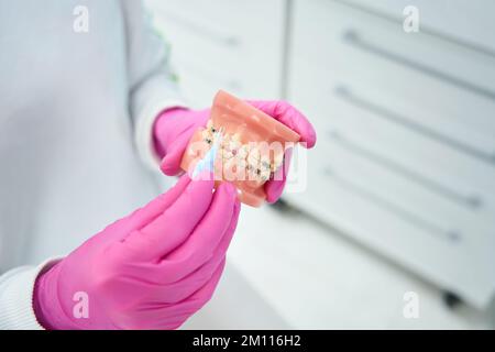 L'orthodontiste tient dans ses mains un modèle de la dentition Banque D'Images