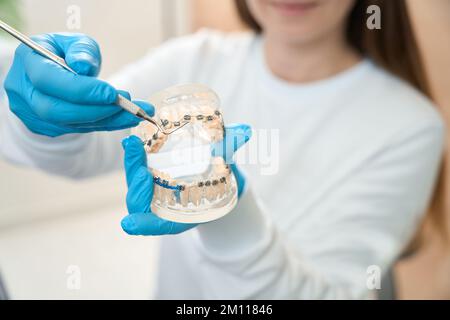 L'hygiéniste dentaire tient la dentition modèle avec des bretelles dans ses mains Banque D'Images