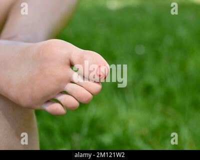 Marche pieds nus - gros plan des pieds des femmes avec zone marquée sur le gros orteil (hallux) pour le massage de réflexologie Banque D'Images