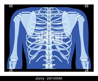 Cage thoracique et mains X-Ray squelette os du corps humain adultes roentgen vue arrière. 3D concept bleu plat réaliste illustration vectorielle de l'anatomie médicale isolée sur fond noir Illustration de Vecteur