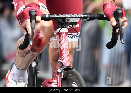 L'illustration montre la jambe blessée de Swiss reto Hollenstein de Team Katusha Alpecin après la deuxième étape de l'édition 104rth de la course cycliste Tour de France, 203,5km de Düsseldorf, Allemagne, à Liège, Belgique, Dimanche 02 juillet 2017. Le Tour de France de cette année a lieu du 1er juillet à 23 juillet. BELGA PHOTO YORICK JANSENS Banque D'Images