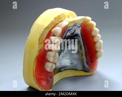 Prothèse dentaire | Prothèse dentaire imprimante en plateau et prothèse 13/03/2018 Banque D'Images