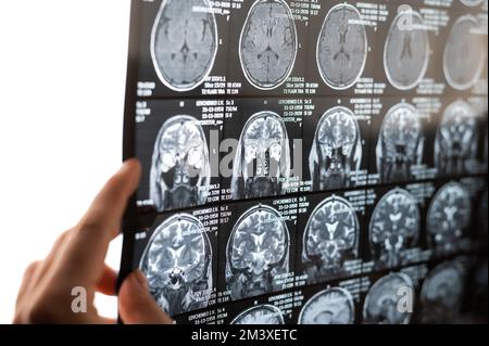 Une femme médecin examine une IRM du cerveau. Banque D'Images