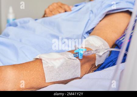 détail du bras de la femme âgée avec une ligne intraveineuse sur la civière dans la chambre d'hôpital Banque D'Images