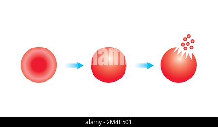 Conception scientifique de l'hémolyse. La destruction des globules rouges. Symboles colorés. Illustration vectorielle. Illustration de Vecteur