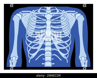 X-Ray cage thoracique et mains squelette humains corps os adultes personnes roentgen vue de face. 3D concept bleu plat réaliste illustration vectorielle de l'anatomie médicale isolée sur fond noir Illustration de Vecteur